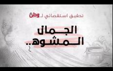 تحقيق استقصائي لوطن بعنوان: الجمال المشوه