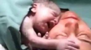 (بالفيديو) مشاهد مؤثرة لطفل حديث الولادة يرفض الانفصال عن أمه