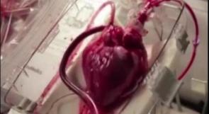 بالفيديو: قلب طبيعي ينبض للمرة الأولى خارج الجسم البشري