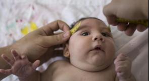 وفاة 139 طفلاً جراء فيروس زيكا في البرازيل
