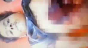 خاص لـ "وطن": بالفيديو... غزة: الشهيد الطفل أنس حاول جمع أحشاء بطنه كي يبقى حيًا