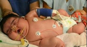 ولادة أضخم طفلة في العالم