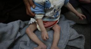 "هيومن رايتس ووتش": التجويع الذي تفرضه "إسرائيل" على غزة يقتل الأطفال