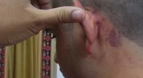 مستوطنون يعتدون على فتى في طريقه للمدرسة بالقدس