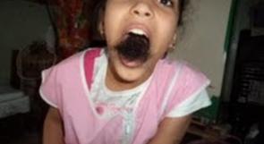 طفلة جزائرية تُخرج شعرا ملونا من فمها
