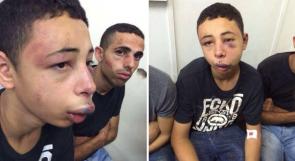 الخارجية الامريكية تطالب بتحقيق في اعتداء قوات الاحتلال على الفتى طارق خضير