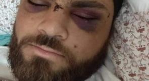 المحرر محمد السلايمة.. حالته تفضح وحشية القمع الذي تعرض له أسرى قسم 4 في النقب قبل أيام