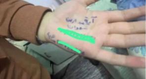 زينب الغنيمي تكتب لوطن من غزة: الشهداء في قطاع غزة يكتبون أسماءهم على أيديهم