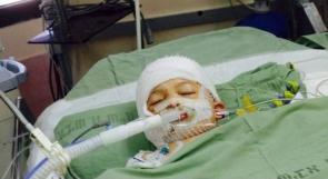 بالفيديو ... الطفل أحمد دوابشة يفتح عينيه للمرة الأولى