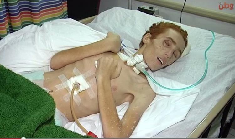 خاص لـ "وطن": بالفيديو... مسؤول لعم الجريح سحويل: هناك 2000 جريح في غزة وابنك بالجُملة خاص لـ "وطن": بالفيديو... مسؤول لعم الجريح سحويل: هناك 2000 جريح في غزة وابنك بالجُملة