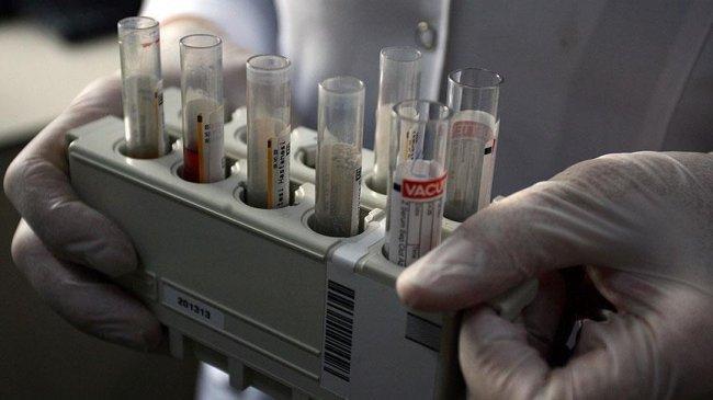 اختبار جديد للدم يكشف عن تلف الكبد في أقل من ساعة
