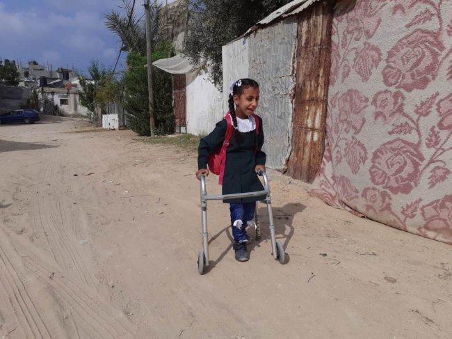 الإغاثة الطبية حققت نقلة نوعية في حياة الطفلة رجاء أبو خوصة في شمال غزة