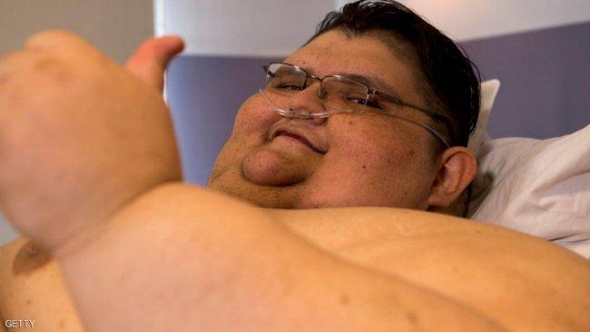 رجل يزن 500 كليوغرام.. يتنفس الصعداء بعدا ان فقد جزء من وزنه