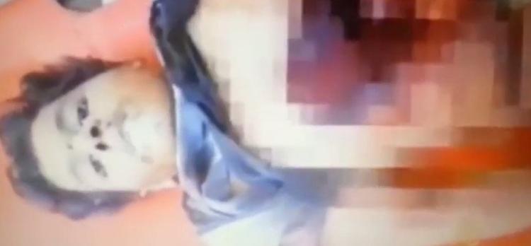 خاص لـ "وطن": بالفيديو... غزة: الشهيد الطفل أنس حاول جمع أحشاء بطنه كي يبقى حيًا خاص لـ "وطن": بالفيديو... غزة: الشهيد الطفل أنس حاول جمع أحشاء بطنه كي يبقى حيًا