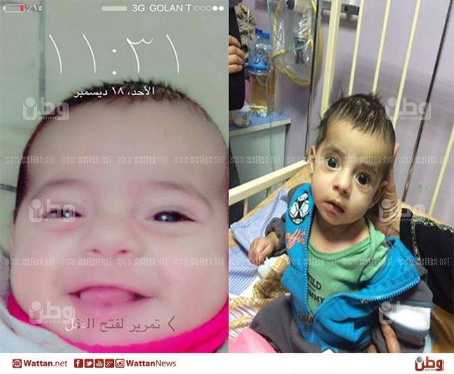 الرضيع حسن، يفقد السمع والبصر بعد علاج في مشفى حكومي