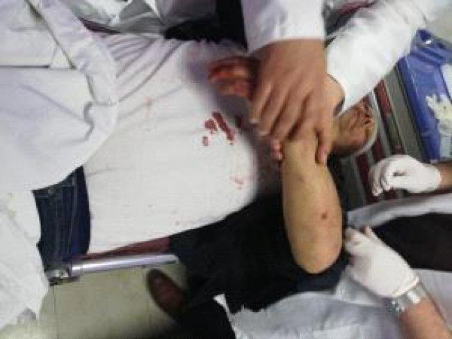 صور | إصابة الناطق باسم فتح عاطف أبو سيف بكسور جراء الاعتداء عليه في غزة
