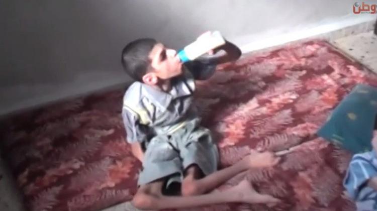 خاص لـ "وطن": بالفيديو... طولكرم: وسيم ويحيى أنهكت جسدهما الإعاقة والوضع المعيشي السيء خاص لـ "وطن": بالفيديو... طولكرم: وسيم ويحيى أنهكت جسدهما الإعاقة والوضع المعيشي السيء