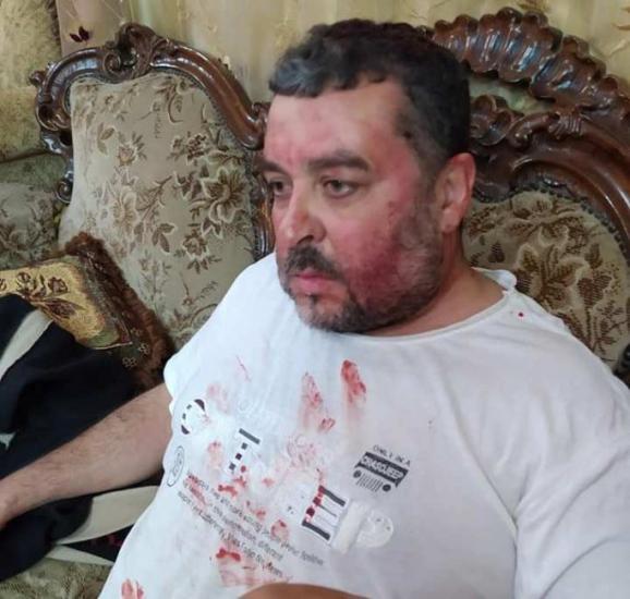 يعبد: الاحتلال يعتقل الشاب براء علي ويعتدي بالضرب على عائلة حمارشة يعبد: الاحتلال يعتقل الشاب براء علي ويعتدي بالضرب على عائلة حمارشة