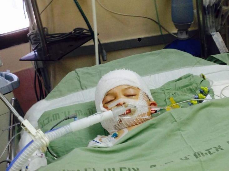 حالة عائلة دوابشة ما تزال خطرة حالة عائلة دوابشة ما تزال خطرة