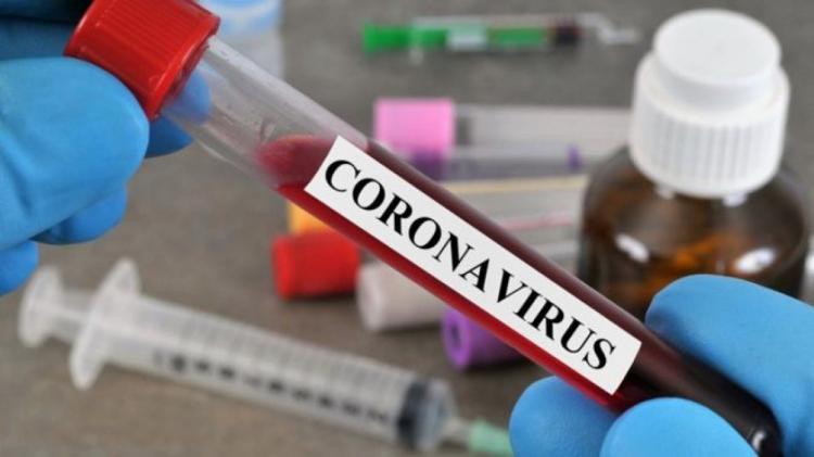9 وفيات و270 إصابة جديدة بفيروس "كورونا" و1270 حالة تعافٍ