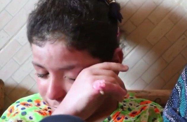 خاص لـ "وطن": بالفيديو... الطفلة "شهد".. شاهدة على قصفٍ خَطَفَ ثلاثة من عائلتها خاص لـ "وطن": بالفيديو... الطفلة "شهد".. شاهدة على قصفٍ خَطَفَ ثلاثة من عائلتها