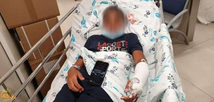 صور | إصابة 3 فتية باعتداءات شرطة الاحتلال على متظاهرين في يافا