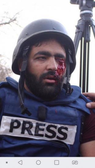الاتحاد الدولي للصحفيين يندد بإصابة المصور الصحفي عمارنة