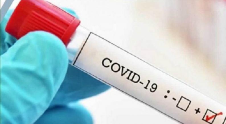 الصحة: تسجيل 419 إصابة جديدة بفيروس كورونا و170 حالة تعافٍ