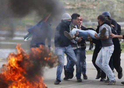 وزارة الصحة:129 مصابا نتيجة المواجهات مع الاحتلال في الضفة