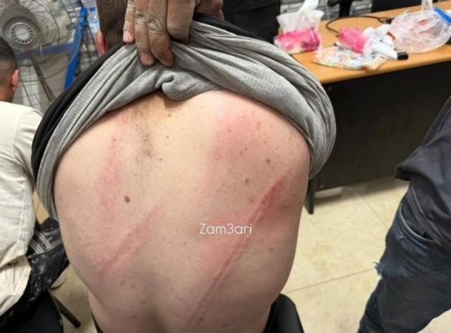 إصابتان باعتداء مستوطنين على قاطفي الزيتون في قرية دير بزيع غرب رام الله إصابتان باعتداء مستوطنين على قاطفي الزيتون في قرية دير بزيع غرب رام الله