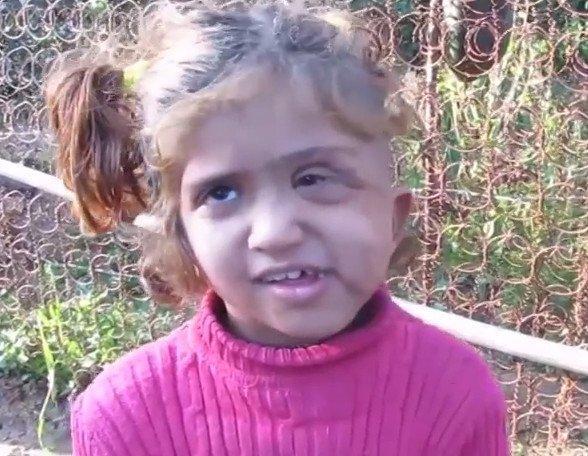خاص لـ "وطن": بالفيديو... غزة: الطفلة انشراح هاجمها الثعبان بعدما نهشها السرطان خاص لـ "وطن": بالفيديو... غزة: الطفلة انشراح هاجمها الثعبان بعدما نهشها السرطان