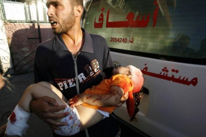 45 جريحًا بإعاقات وبتر أطراف من غزة سيغادرون الي ألمانيا اليوم