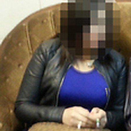 الفتاة التي هوجمت بمادة حمضية في الناصرة قد تفقد البصر جزئيا أو كليا