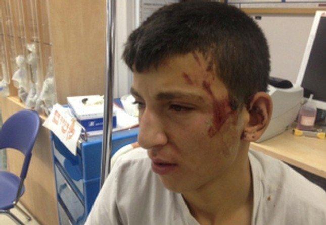 مستوطنون يعتدون على فتى مقدسي مستوطنون يعتدون على فتى مقدسي