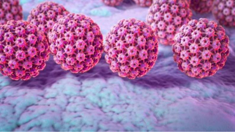 علماء ولأول مرة يجدون صلة قوية بين فيروس ينتقل جنسيا والإصابة بسرطان البروستات