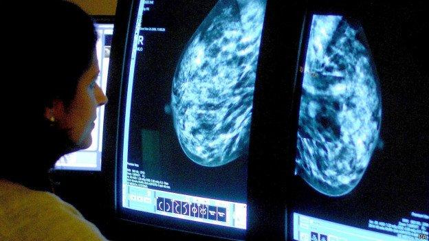 بحوث سرطان الدم وأمل اكتشاف عقاقير جديدة لسرطان الثدي
