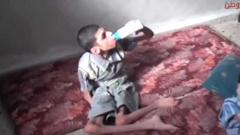 خاص لـ "وطن": بالفيديو... طولكرم: وسيم ويحيى أنهكت جسدهما الإعاقة والوضع المعيشي السيء خاص لـ "وطن": بالفيديو... طولكرم: وسيم ويحيى أنهكت جسدهما الإعاقة والوضع المعيشي السيء