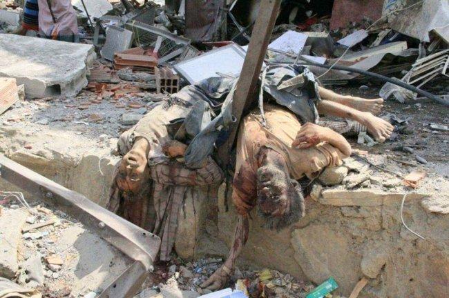 قتلى وجرحى في قصف سعودي شمال اليمن