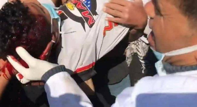 اصابة فتى بجروح خطيرة برصاص الاحتلال شرق خانيونس
