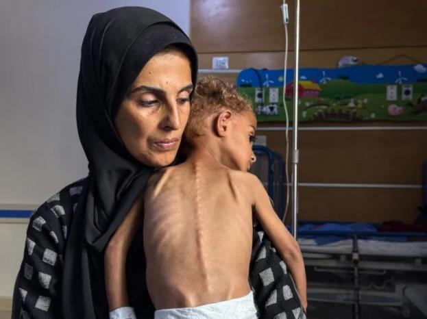 466 وفاة بالتجويع في غزة منذ 2024.. بينهم 157 طفلا 466 وفاة بالتجويع في غزة منذ 2024.. بينهم 157 طفلا