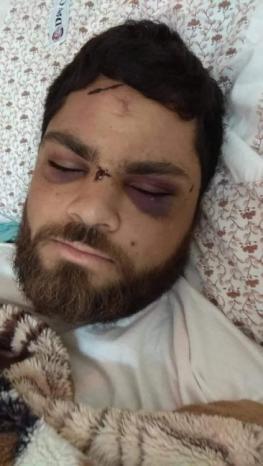 المحرر محمد السلايمة.. حالته تفضح وحشية القمع الذي تعرض له أسرى قسم 4 في النقب قبل أيام