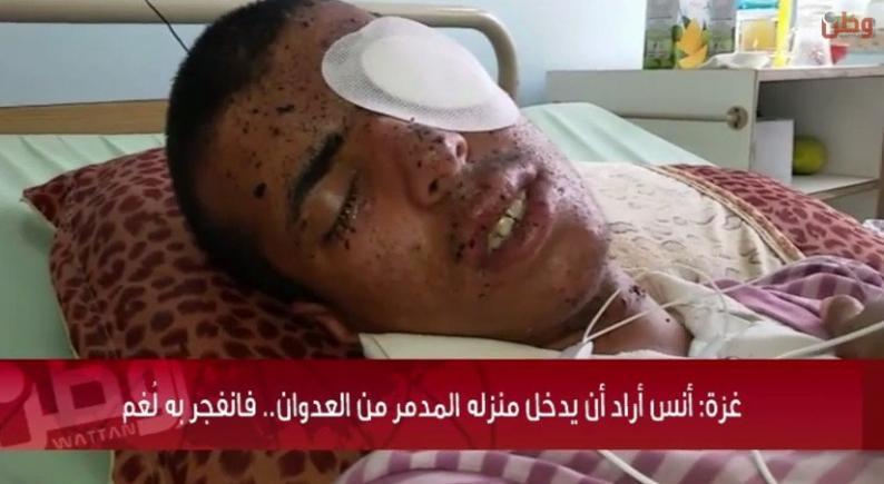 خاص لـ "وطن": بالفيديو... غزة: أنس أراد أن يدخل منزله المدمر من العدوان.. فانفجر به لُّغم خاص لـ "وطن": بالفيديو... غزة: أنس أراد أن يدخل منزله المدمر من العدوان.. فانفجر به لُّغم